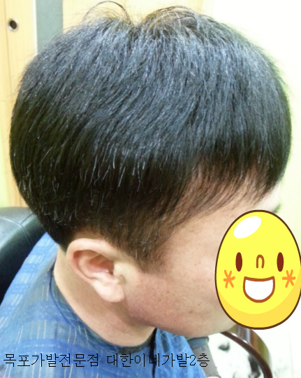 목포 가발 남성부분가발 맞춤후 착용