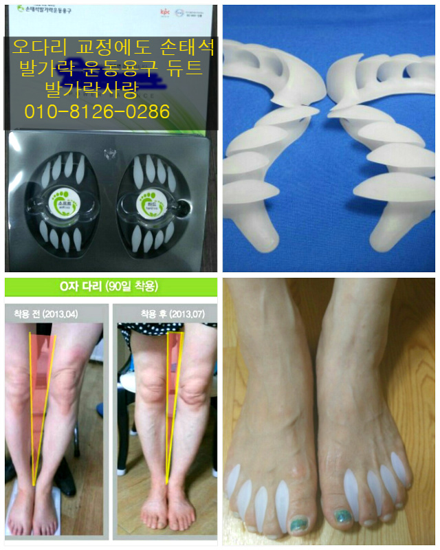 무릎관절을 지켜주자